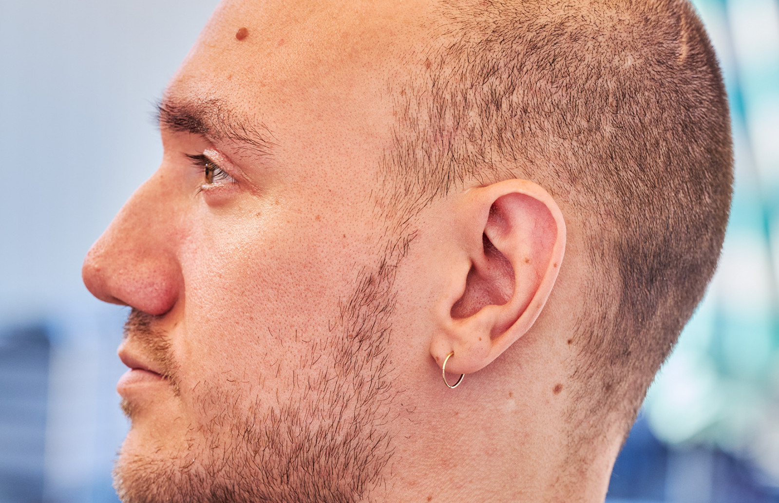 Prvi pacijent Neuralinka: Potpuno me je oduševilo