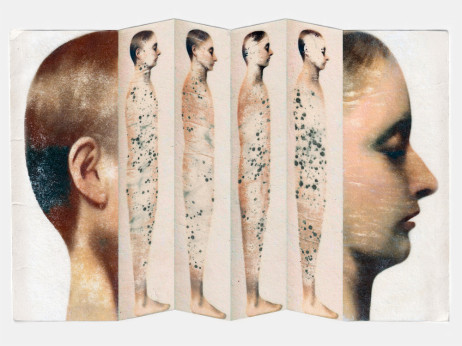 Kako kovid potajno menja mozak